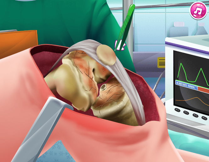 Diz Ameliyatı Simülatörü